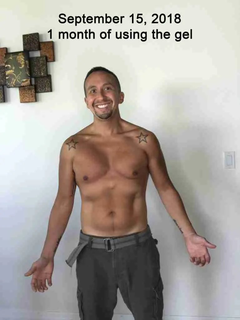 Month 1 of using Somaderm