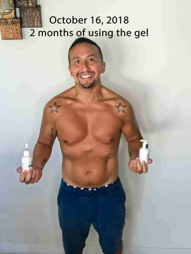 Month 2 of using Somaderm