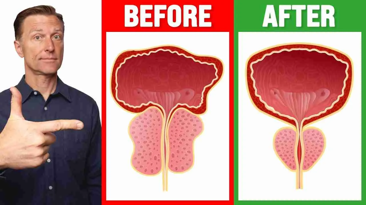 Dr Berg - most important nutrient for prostate health