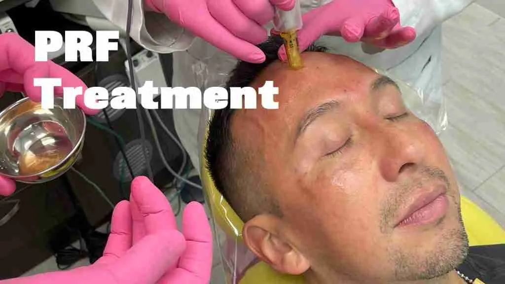 PRF Treatment at Blossom Dental Ormond Beach